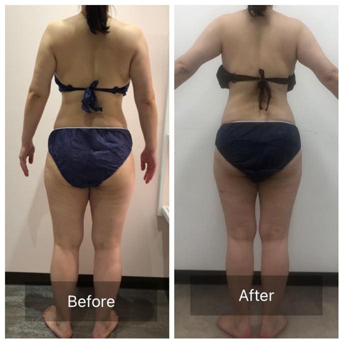 ビフォーアフター - 下半身集中コース