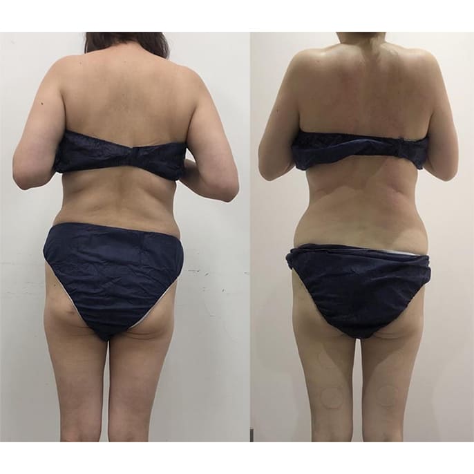 ビフォーアフター - 上半身集中コース